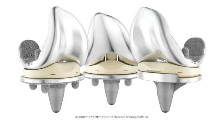 DePuy Synthes Expands its ATTUNE Knee Platform With Cementless Option