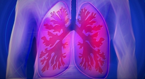 Easy Breezy: IoT Guarding Lung Health