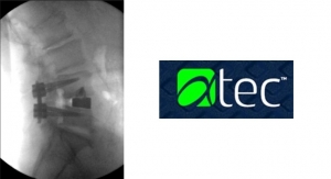 Alphatec Launches IdentiTi Implants for Lateral Interbody Fusion 