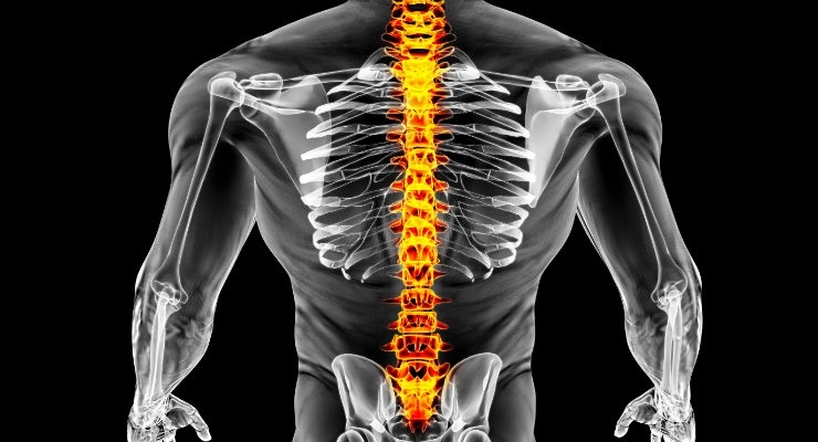 Micro Spine Implant Could Restore Standing and Walking