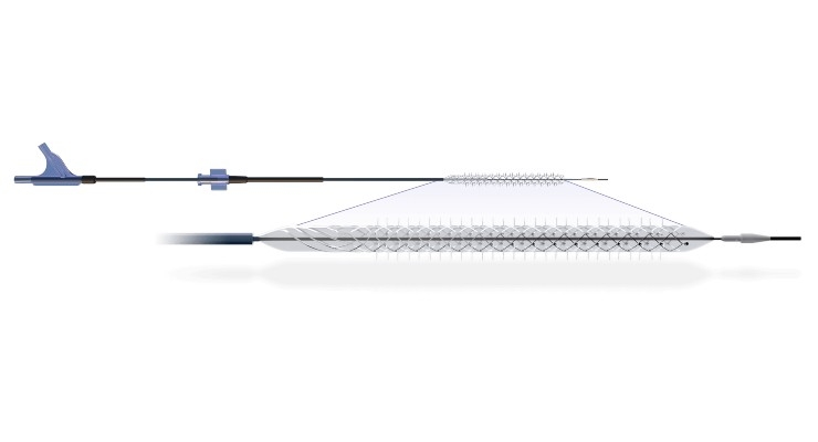 Reflow Medical’s Temporary Spur Stent Wins Breakthrough Status