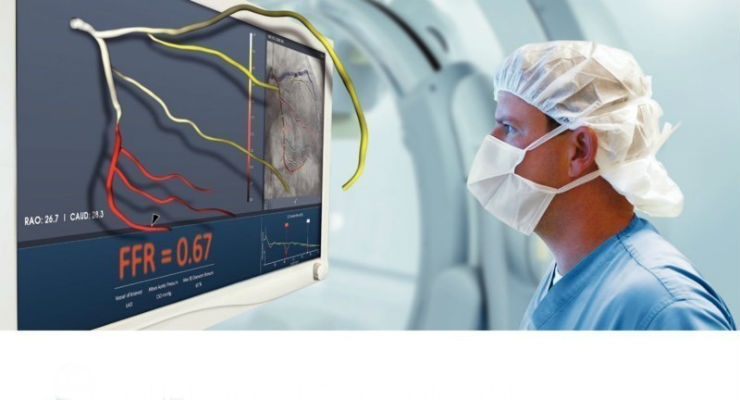 Japanese Regulators Approve Non-Invasive Angiography Technology