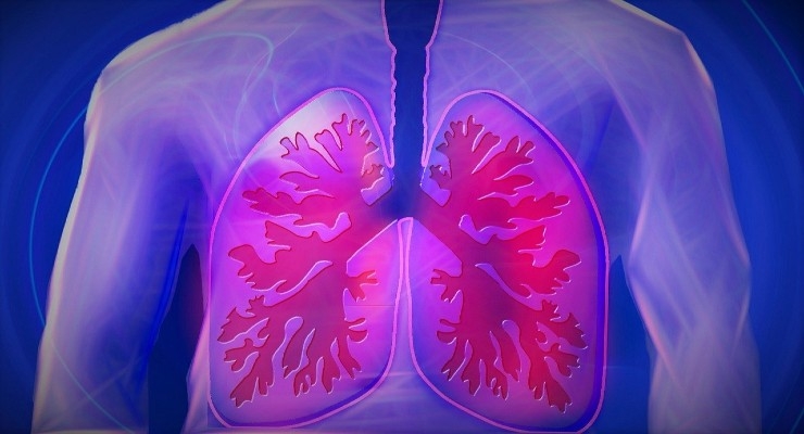 FDA Clears Paragonix Technologies’ LUNGguard for Donor Lung Preservation