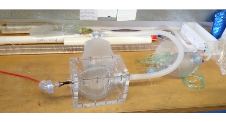 Oxford and King’s Developing Prototype for Rapidly Deployable Ventilator