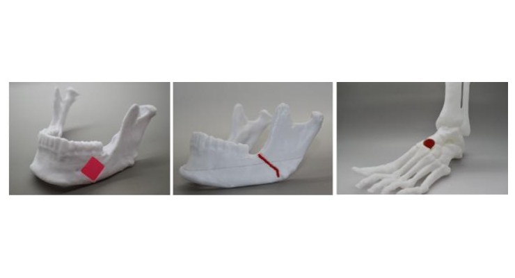 Lab Engineers 3D-Functional Bone Tissues