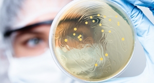 Innovative Product Development Strategies to Launch Probiotics