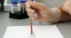 NeuMoDx Molecular Receives CE Marking for HIV Viral Load Assay