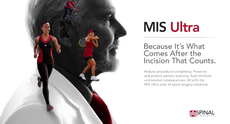Spinal Elements Launches MIS Ultra Platform