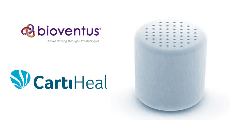 Bioventus Invests in CartiHeal with Option to Acquire