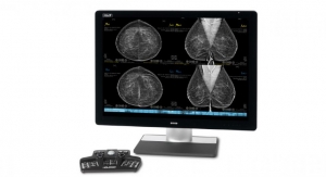 RadNet, Hologic Collaborate on AI for Breast Health