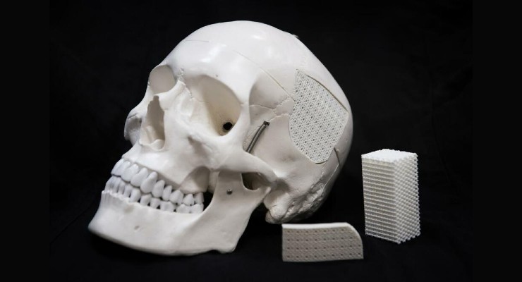 Eggshell-Based Surgical Material for Skull Injuries
