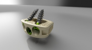 First 3D Printed HAnano Surface Modified Implant Gets FDA Approval