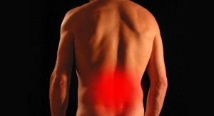 Abbott Begins Study of BurstDR Stimulation for Non-Operative Low Back Pain