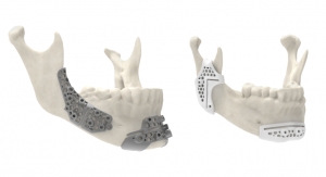 3D Systems Cleared by FDA for Improved Patient-Matched Surgical Guidance