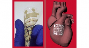University of Houston: Implantable Device Can Monitor, Treat Heart Disease