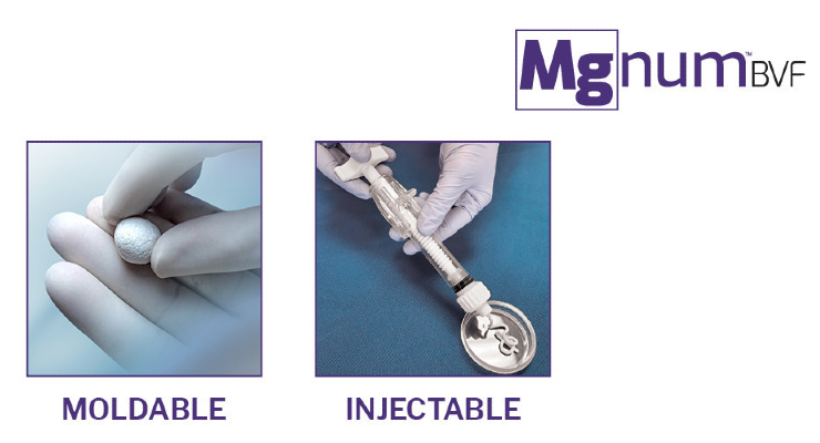 Paragon 28 Launches MgNum Bone Void Filler
