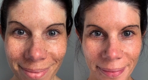 Rodan + Fields Tackles Discoloration and Irritation in New Regimens
