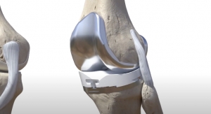 Microport Orthopedics Launches Kinematic Alignment Approach