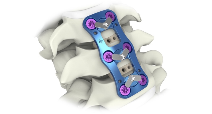 Aurora Spine Receives FDA 510(k) Clearance for Anterior Cervical Plate System