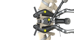Comprehensive Tool Set Key to Lateral Access Spine Surgery Success