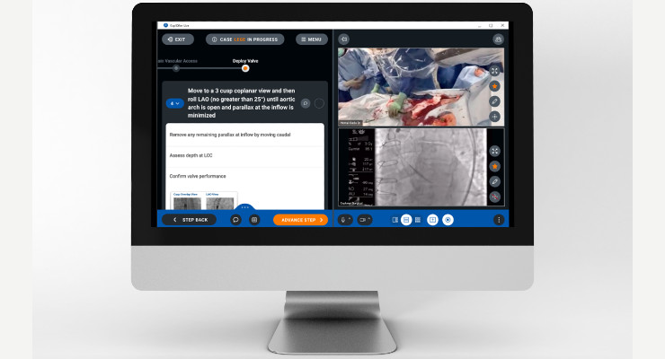 Explorer Surgical Launches Sales Training Platform with Remote Case Observation