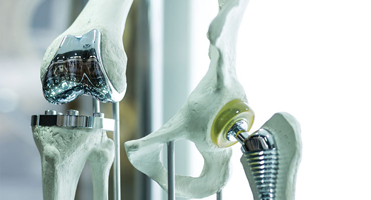 Orthopedic Industry Insights and Reflections