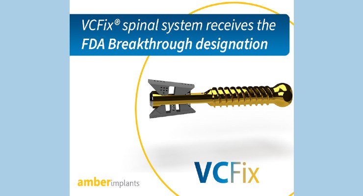 Amber Implants VCFix Spinal System Earns FDA Breakthrough Nod
