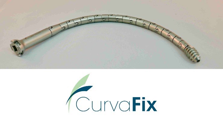 CurvaFix IM Implant for Pelvic Fracture Rolls Out