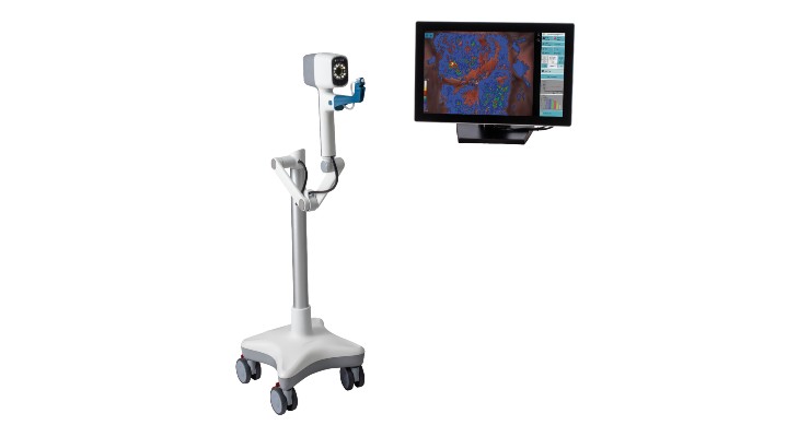 DYSIS Launches New Compact Portable Colposcope