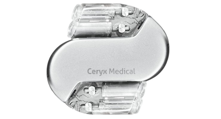 Cysoni Bionic Device Shows Promising Results in Pre-Clinical Data
