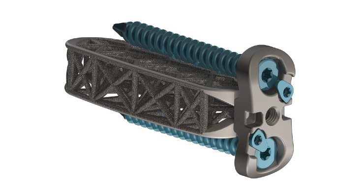 4WEB Launches Hyperlordotic Lateral Spine Implants
