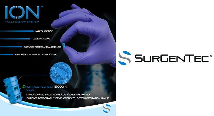 SurGenTec Unveils ION Screw for Posterior Spinal Fixation