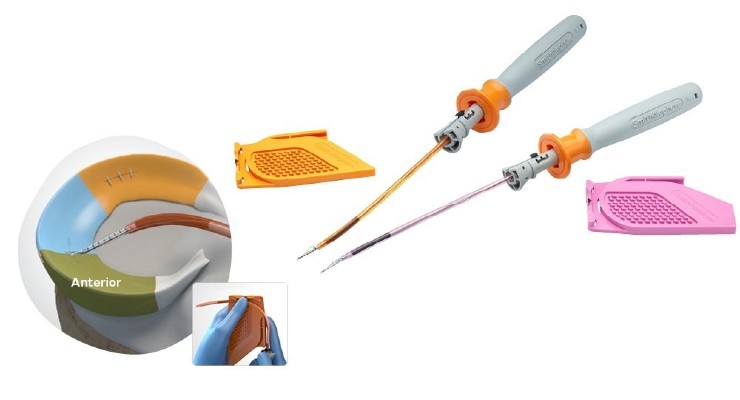 AAOS22: Smith+Nephew to Feature Latest Sports Med Tech