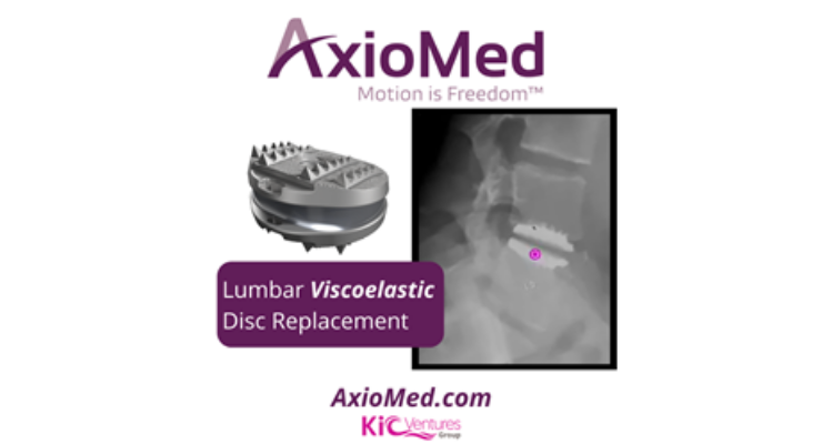 AxioMed Gets Closer to FDA Market Approval for its Lumbar Disc Replacement