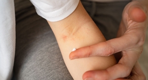 What’s the Right Moisturizer Format for Children with Eczema?