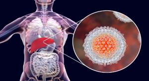 Roche Rolls Out Elecsys HCV Duo Immunoassay in Europe
