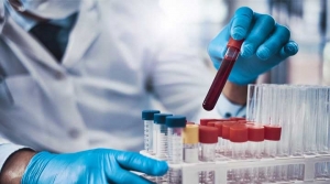 Labcorp Launches New Test to Identify, Confirm Neurodegenerative Disease