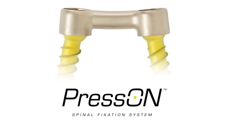 Nexus Spine Launches PressON Posterior Lumbar Fixation System