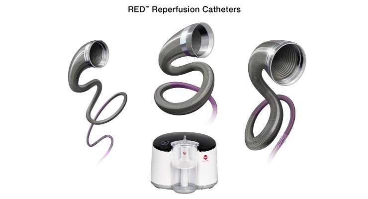 Penumbra Rolls Out RED Reperfusion Catheters in Europe 