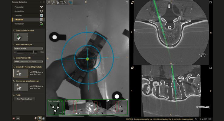 Royal Philips Expands Rollout of ClarifEye AR Surgical Navigation Solution to Japan