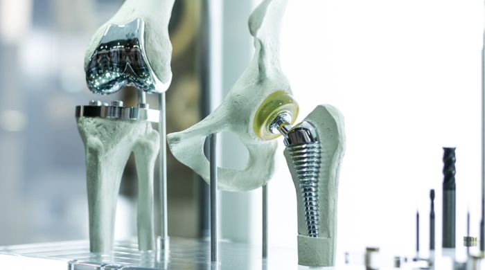 How Orthopedic Composites Solve Problems Related to Devices and Equipment