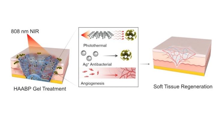 Researchers Develop Hydrogel Injections to Treat Antibiotic-Resistant Infections