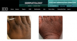 Dermatology & Inclusivity: Free Online Gallery Shows Derm Conditions in Array of Skin Tones
