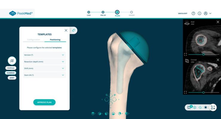 PeekMed Launches Automated Orthopedic Solution
