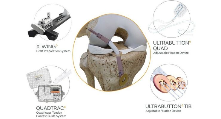 Smith+Nephew Introduces Procedural Solution for ACL Reconstruction