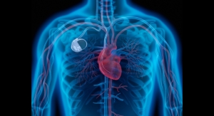 Steady Growth Forecast for Global Pacemakers Market