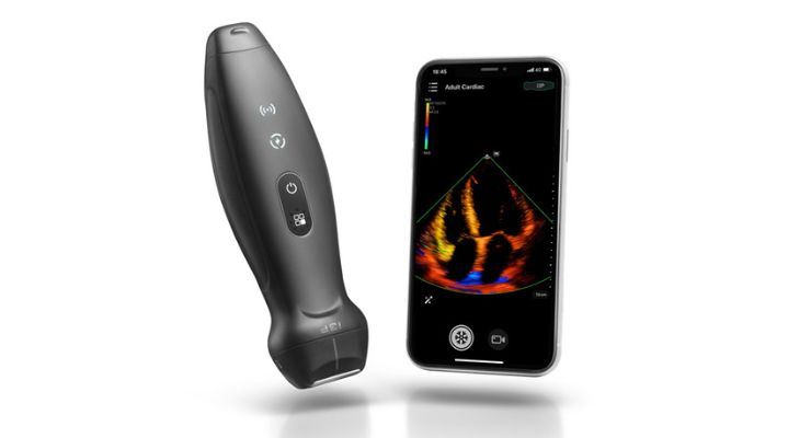 Mindray Releases TE Air Wireless, Handheld Ultrasound