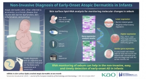 Kao Scientists Develop Novel Method to Detect Early-Onset Infant Atopic Dermatitis