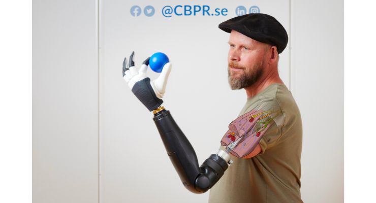 Breakthrough: Bionic Hand Allows Finger Manipulation Just Like a Natural Limb