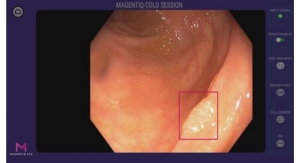 FDA OKs MAGENTIQ-COLO AI Gastrointestinal Lesion Software Detection